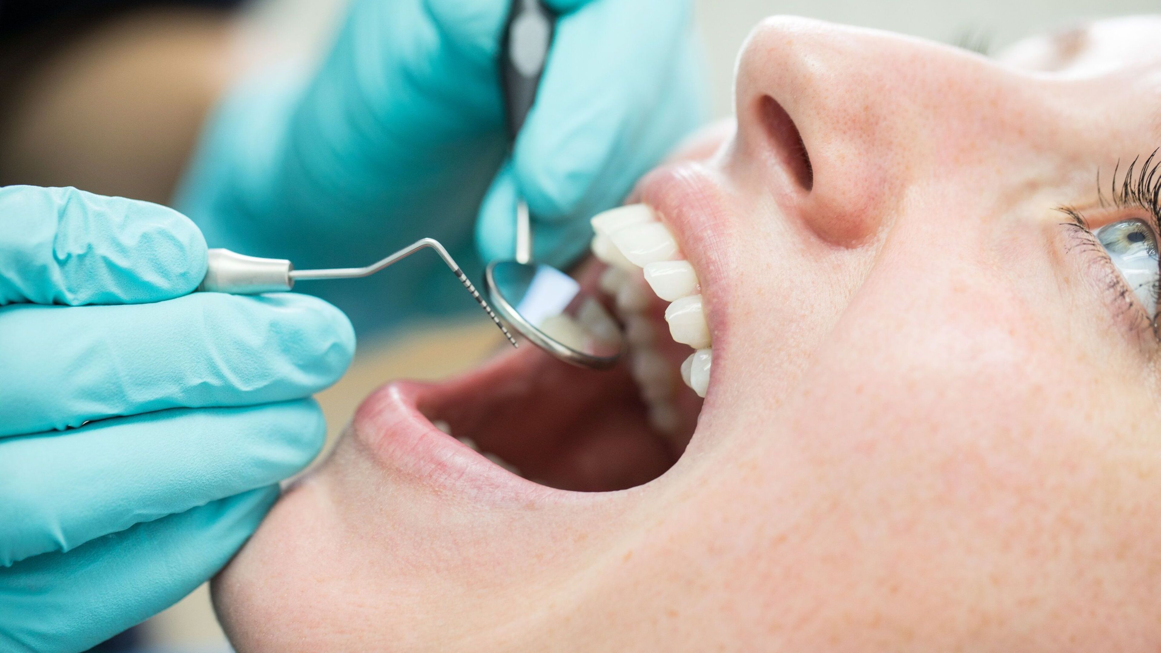 ‘Unjust and unnecessary’ – people with intellectual disabilities twice as likely to lose all their teeth by 40
